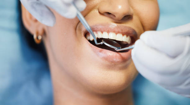 Best Broken or Chipped Tooth Repair in Littlerock, CA